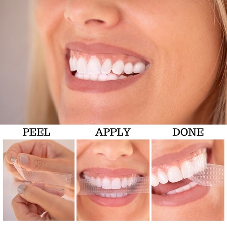 How to use Crest 3D White Strips